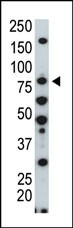 HUNK Antibody