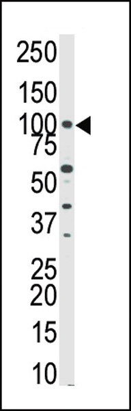 PKN3 Antibody