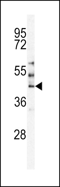 MST3 Antibody