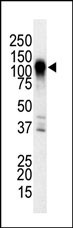 MAP3K6 Antibody