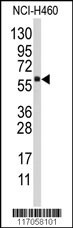 CYP4F12 Antibody