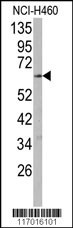 CYP2R1 Antibody