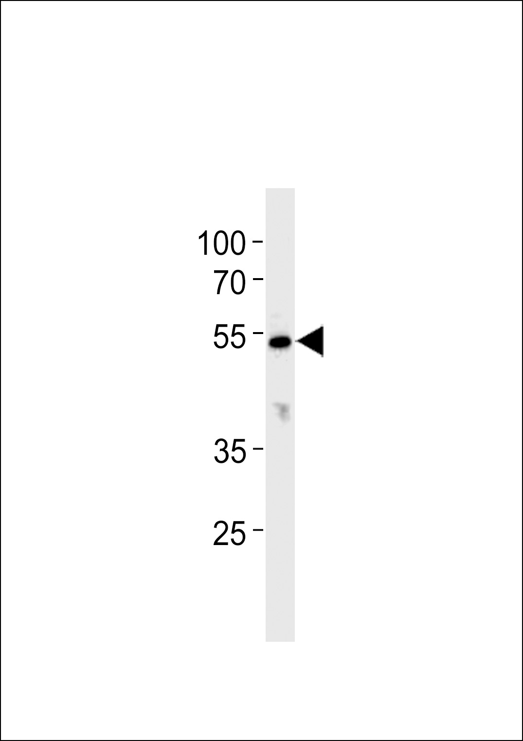 CYP26C1 Antibody