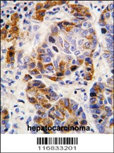 ALDH4A1 Antibody