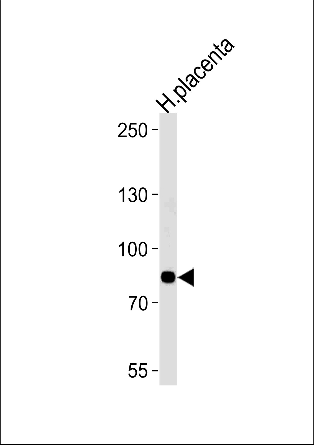 AMPD3 Antibody