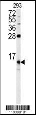 FKBP1B Antibody