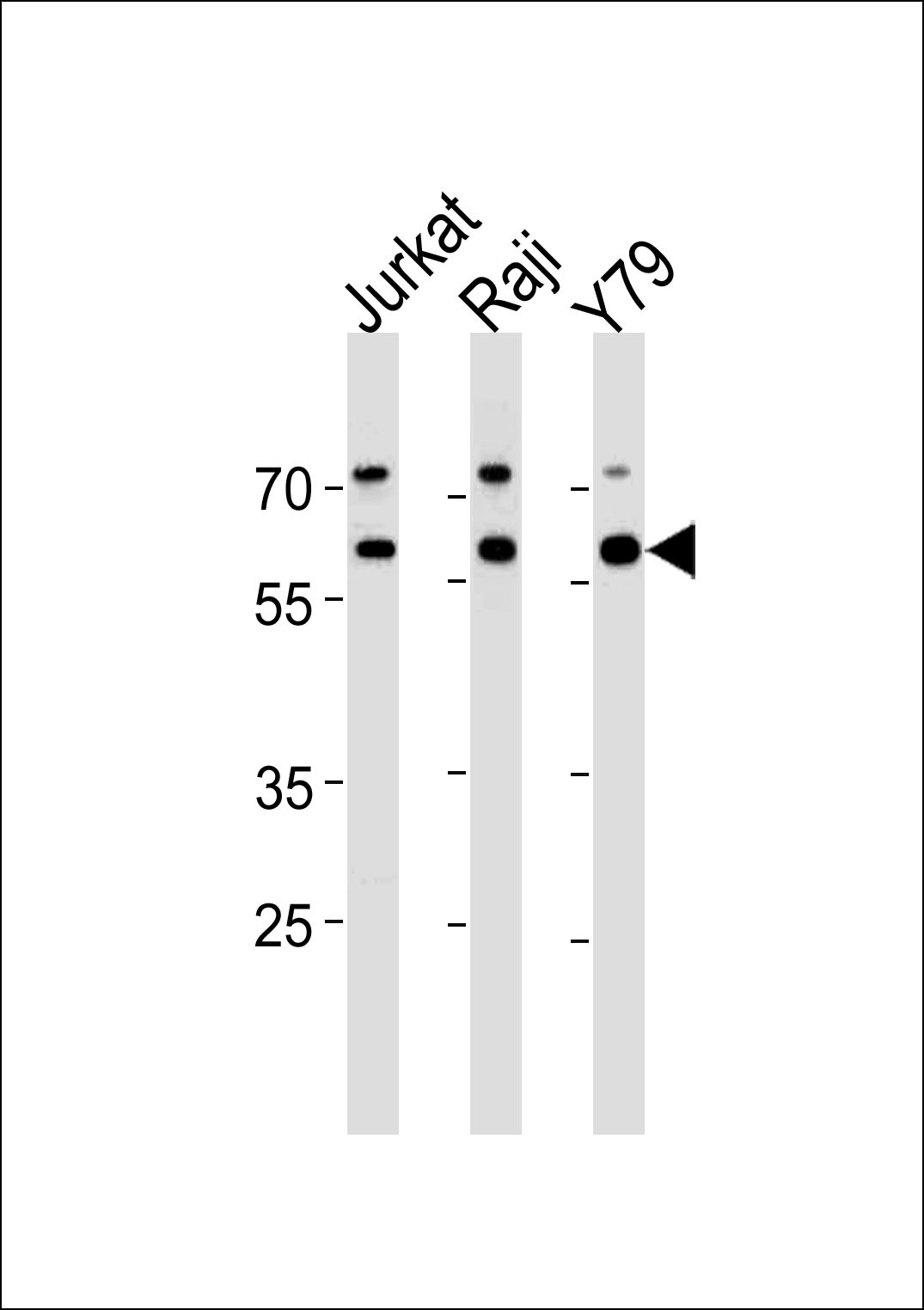 ACHE Antibody