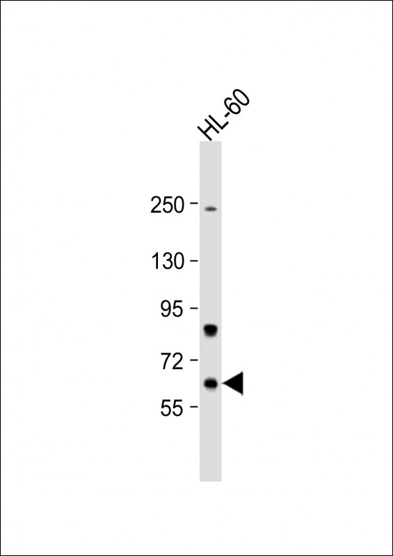 Methionyl tRNA Synthetase Antibody