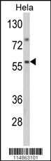 SARS2 Antibody