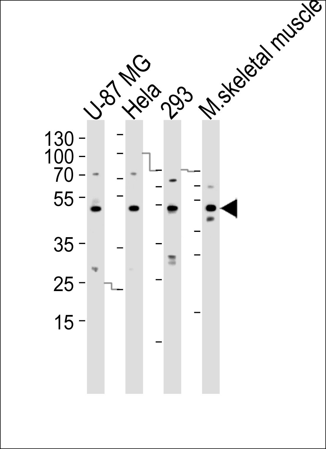 SARS2 Antibody