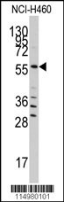 SARS Antibody