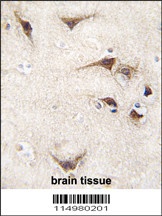 SARS Antibody