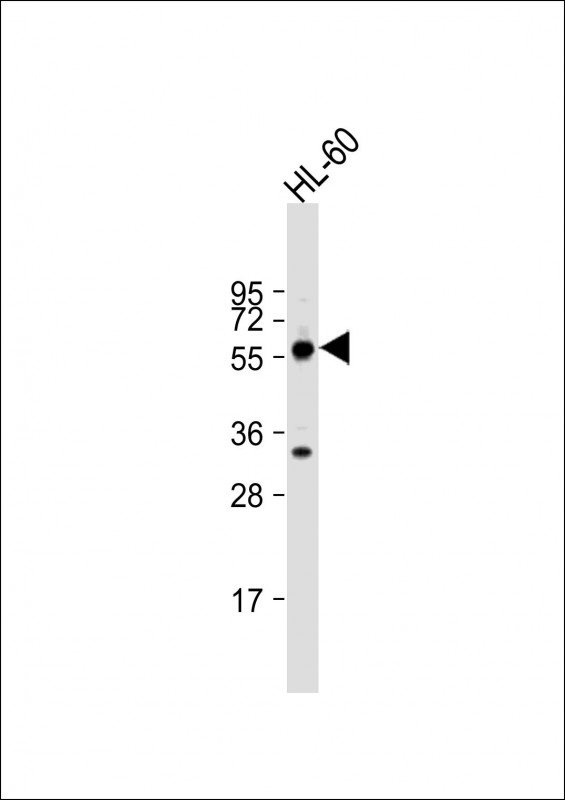 TESK2 Antibody