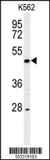 RIPK3 Antibody