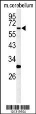 RIPK3 Antibody