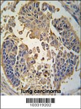 RIPK3 Antibody