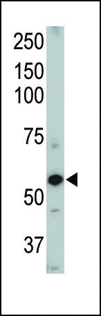 ACVRL1 Antibody