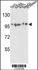 ACTN4 Antibody