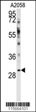 WBP2 Antibody