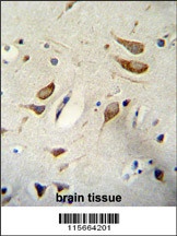 WBP2 Antibody
