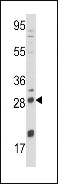 NGF Antibody