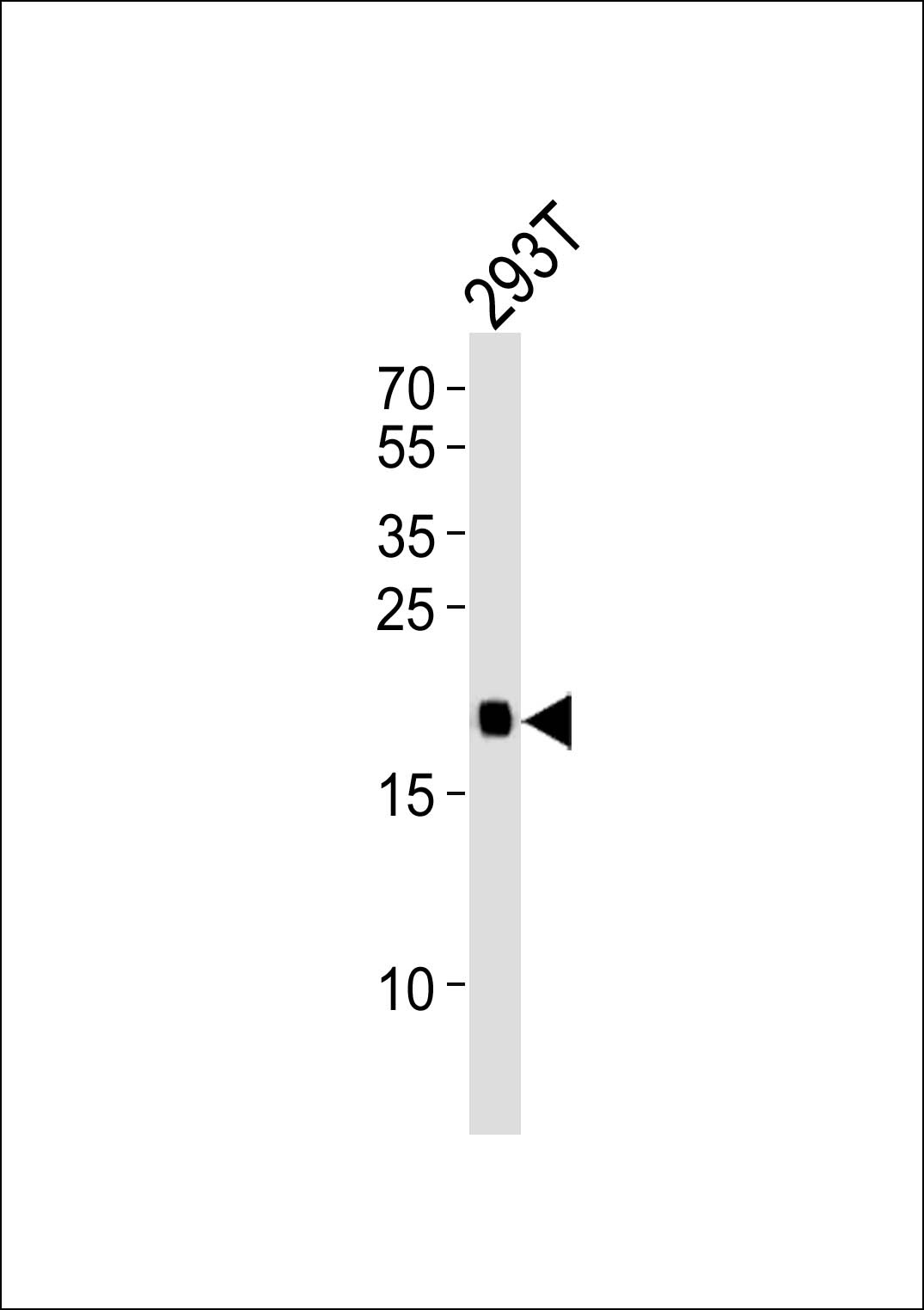 HRAS Antibody