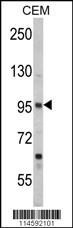 SEMA3A Antibody