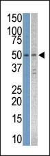 STK38L Antibody