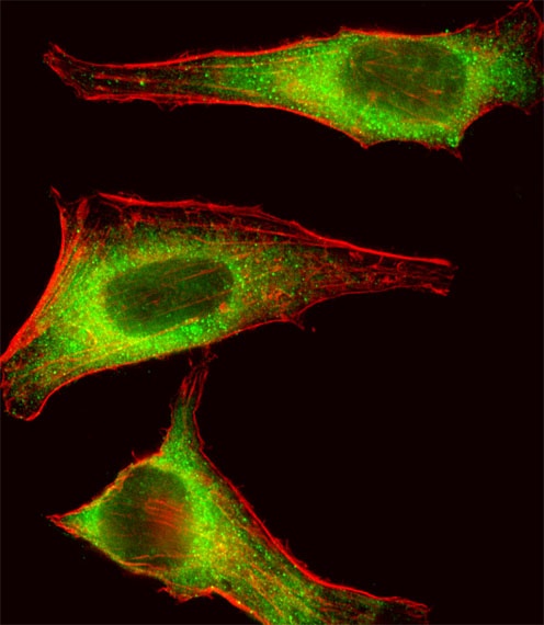 TEC Antibody