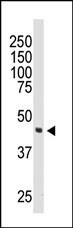 DOK2 Antibody