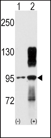 DDR2 Antibody