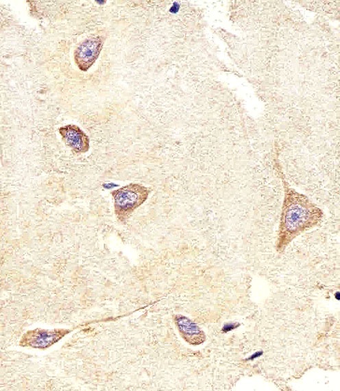 TrkC Antibody