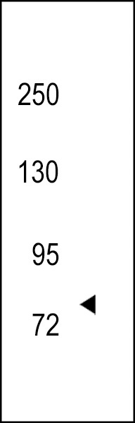 NTRK3 Antibody