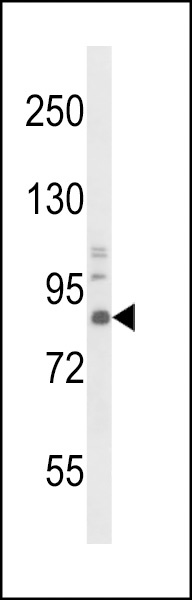 NTRK1 Antibody