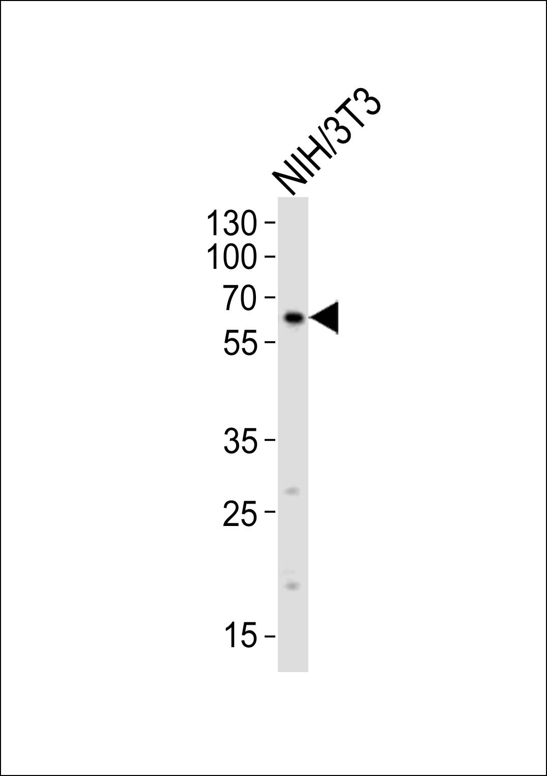 RYK Antibody