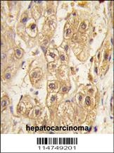 PDGFRB Antibody