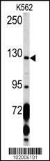 PDGFRA Antibody