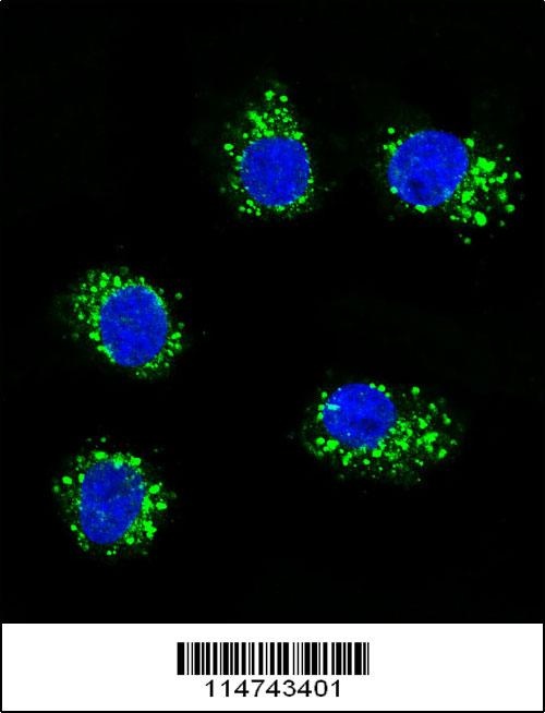 MUSK Antibody