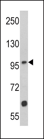 MUSK Antibody