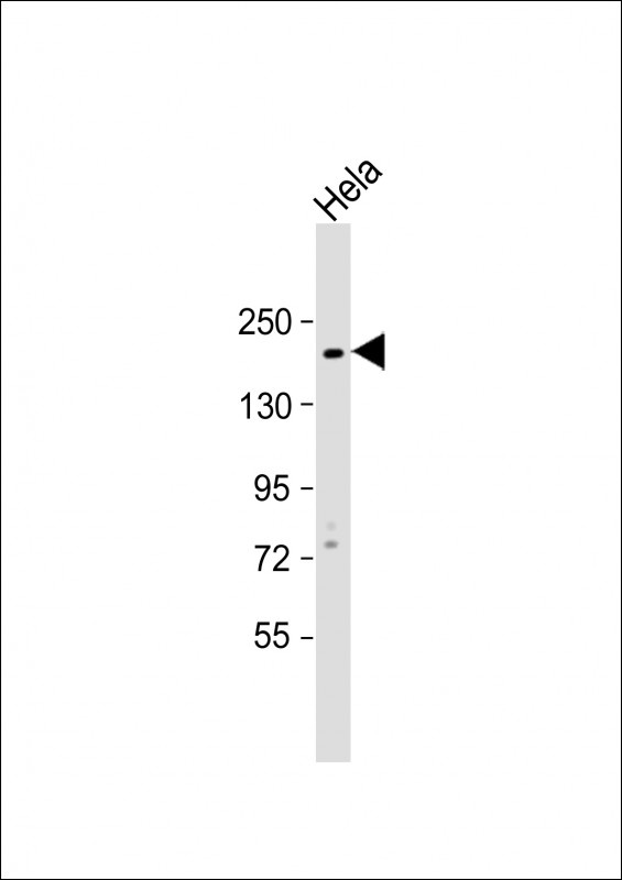 KIT Antibody