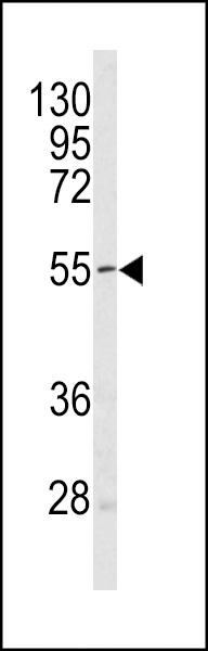 Sestrin-1 Antibody