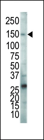 VEGFR2 Antibody