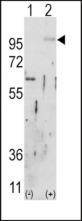 FGFR2 Antibody