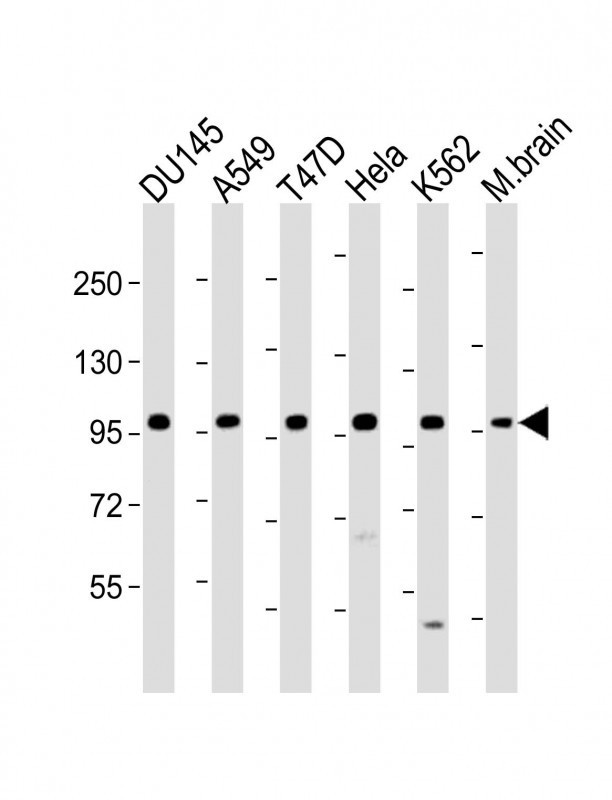 FGFR2 Antibody