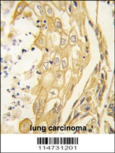EPHB4 Antibody