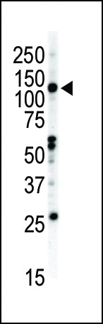 EPHB2 Antibody