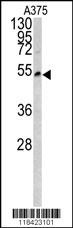 LUM Antibody