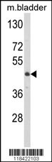 LUM Antibody