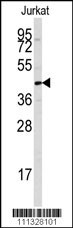 PTPN7 Antibody