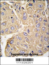 PTPN7 Antibody